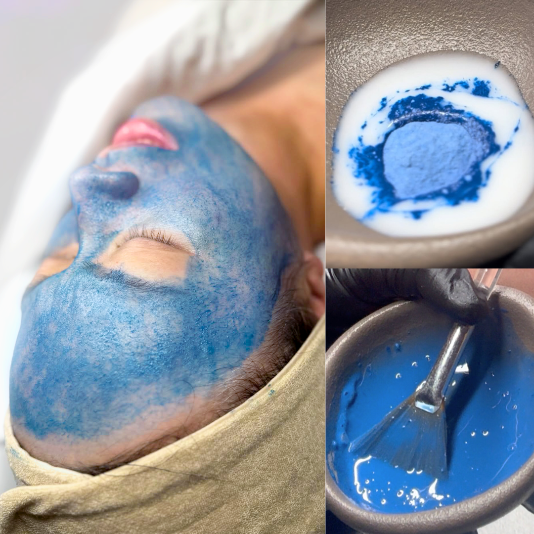 Why the Blue Spicule Peel Is Becoming a Go-To Choice for